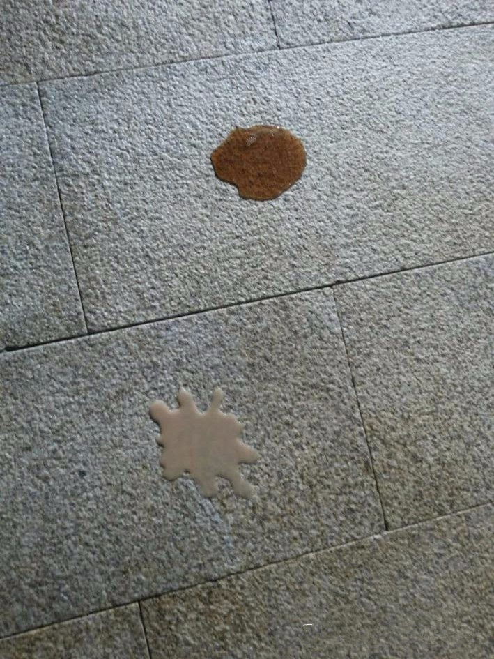 00000